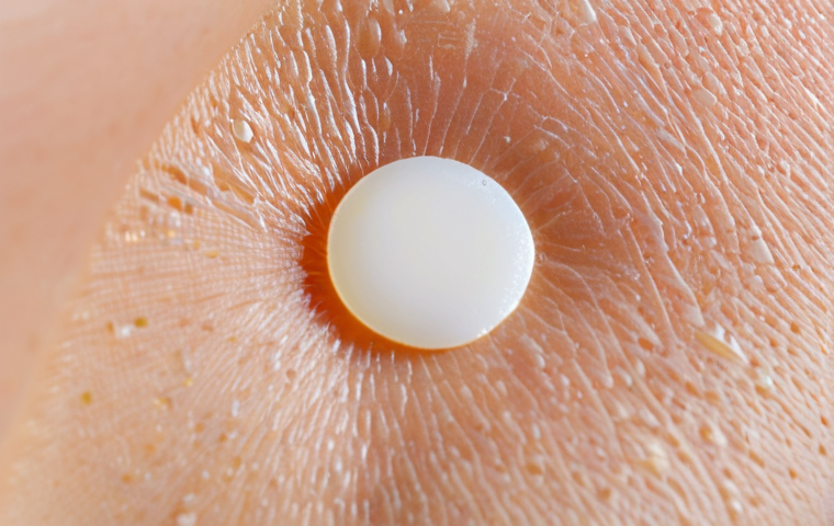 트러블 케어용 패치 제품 비교 - Hydrocolloid Acne Patch Close-up**
"Close-up shot of a hydrocolloid acne patch on clean skin, showi...